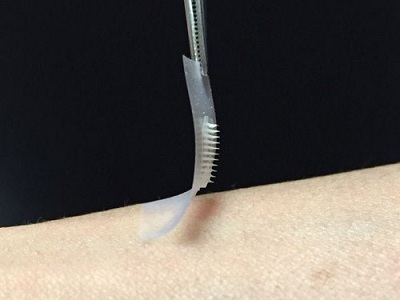 Miếng dán thông minh tự động tiết insulin cho bệnh nhân tiểu đường