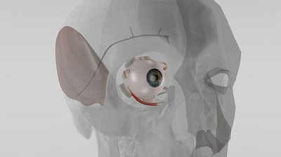 Phương pháp mớiđiều trị tăng nhãn áp