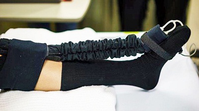 Giảm nguy cơ bị tắc mạch máu cho bệnh nhân liệt giường nhờ vớ robot